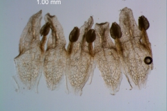 corolla, dissected