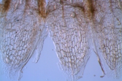 infrastaminal scales