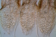infrastaminal scales