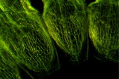 infrastaminal scales