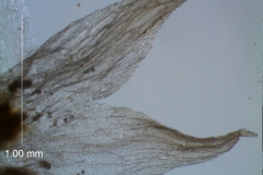 calyx lobes