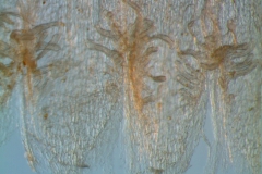 infrastaminal scales