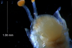 gynoecium