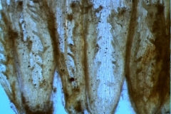 infrastaminal scales