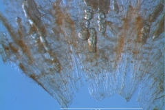 infrastaminal scales