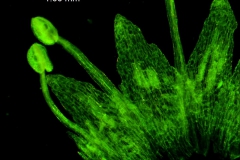 infrastaminal scales