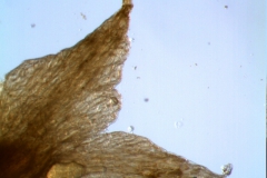 calyx lobe detail