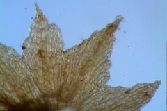 calyx lobe detail