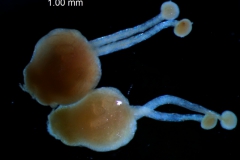 gynoecium