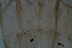 infrastaminal scales