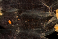 infrastaminal scales