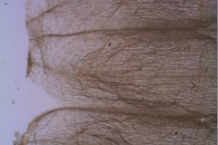 Cuscuta californica var. californica - no infrastaminal scales