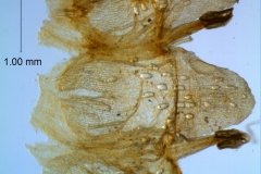 Cuscuta gronovii var. gronovii - infrastaminal scales