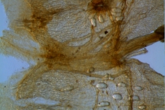 Cuscuta gronovii var. gronovii - infrastaminal scales