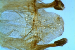 Cuscuta gronovii var. gronovii - infrastaminal scales