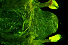 Cuscuta gronovii var. gronovii - infrastaminal scales