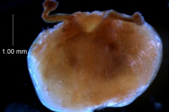 Cuscuta gronovii var. gronovii - capsule