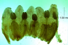 Cuscuta japonica var. formosana - corolla, dissected