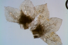 Cuscuta umbellata  var. umbellata - calyx, dissected