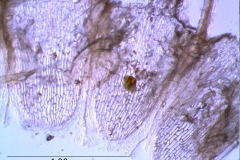 Cuscuta umbellata  var. umbellata - infrastaminal scales