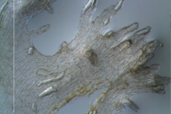 Cuscuta umbrosa - infrastaminal scales detail