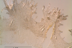 Cuscuta umbrosa - infrastaminal scales detail