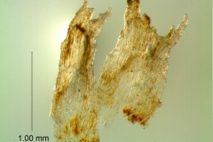 Cuscuta exaltata Engelm. - infrastaminal scales