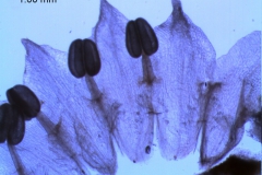 Cuscuta epithymum var. (subsp) epithymum: corolla, dissected