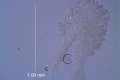 Cuscuta epithymum var. (subsp) epithymum: infrastaminal scale detail