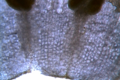 infrastaminal scales