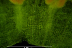 infrastaminal scales