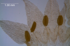 Cuscuta nevadensis - corolla, dissected