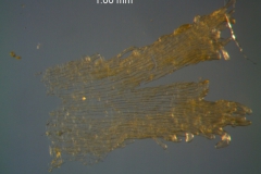 Cuscuta lupuliformis - infrastaminal scale detail