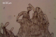 infrastaminal scale detail
