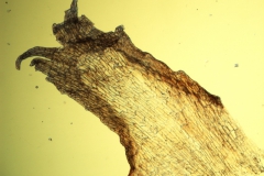 Cuscuta kilimanjari - infrastaminal scale detached