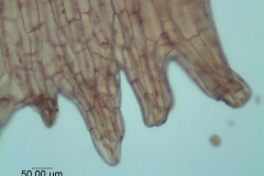 Cuscuta lindsayi -- infrastaminal scale detail