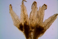 Cuscuta lacerata - calyx, dissected