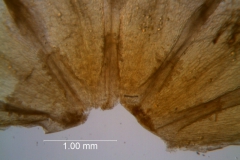 Cuscuta pacifica - infrastaminal scales (dissected corolla)