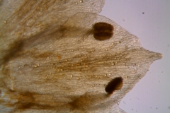 Cuscuta pacifica - corolla lobes (dissected corolla)