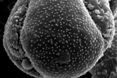 Cuscuta appendiculata; Brakniviet/Hofmeyr/s.n./GAA