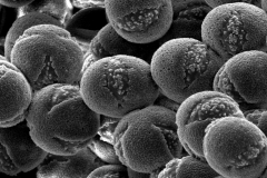 Cuscuta corymbosa var. grandiflora; Mexico/Iltis & Guzman/29077/MEXU