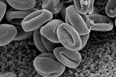 Cuscuta leptantha; Mexico/Lindsay/2928/SD