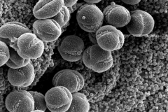 Cuscuta nitida; S. Africa/Rogers/17342/L