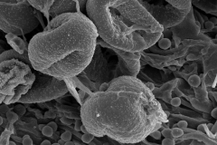 Cuscuta polygonorum;  IN, U.S.A./Yuncker/10836/NY