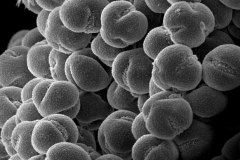 Cuscuta racemosa var. miniata; Brazil/Menezes et. al./5100/CTES