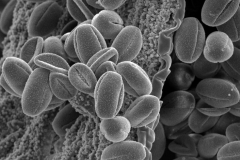 Cuscuta suksdorfii; CA, U.S.A./Twisselmann/14603/SD