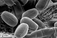 Cuscuta tuberculata; AZ, U.S.A/Beauchamp/3112/SD