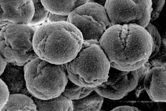 Cuscuta xanthochortos; Argentina/Azbo et. al./6953/MO