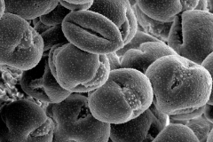 Cuscuta xanthochortos; Argentina/Azbo et. al./6953/MO