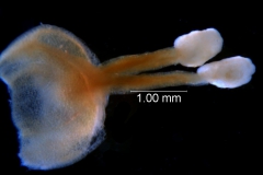 gynoecium